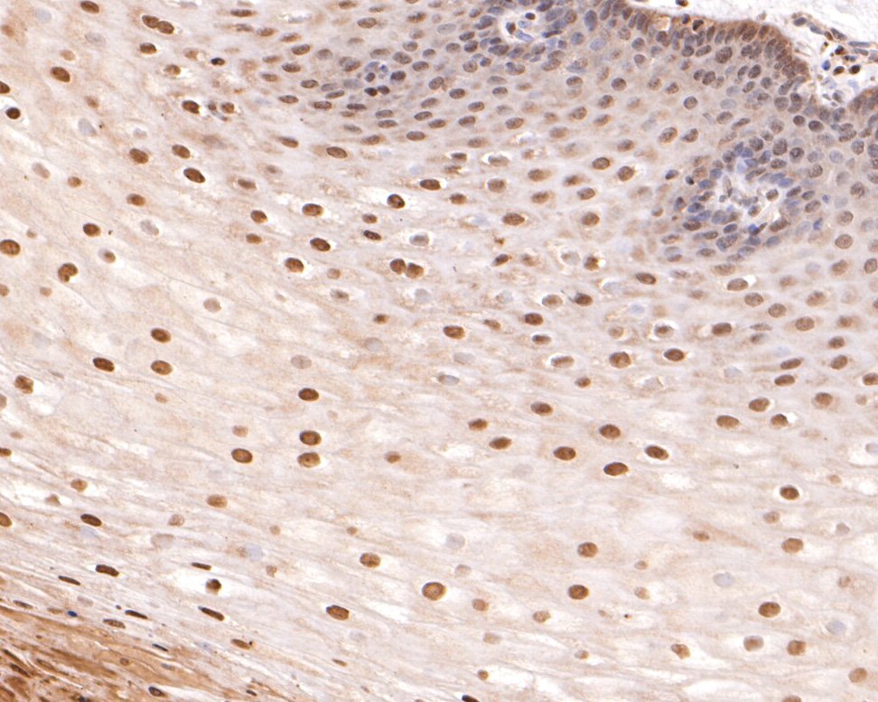 Immunohistochemical analysis of paraffin-embedded human esophagus tissue using anti-Phospho-p53 (T55) antibody. The section was pre-treated using heat mediated antigen retrieval with sodium citrate buffer (pH 6.0) for 20 minutes. The tissues were blocked in 1% BSA for 30 minutes at room temperature, washed with ddH2O and PBS, and then probed with the primary antibody (ET1609-13, 1/400)  for 30 minutes at room temperature. The detection was performed using an HRP conjugated compact polymer system. DAB was used as the chromogen. Tissues were counterstained with hematoxylin and mounted with DPX.