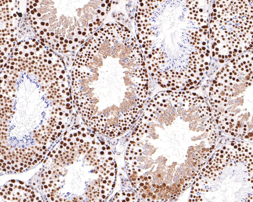 Immunohistochemical analysis of paraffin-embedded mouse testis tissue using anti-ASPP2 antibody. The section was pre-treated using heat mediated antigen retrieval with sodium citrate buffer (pH 6.0) for 20 minutes. The tissues were blocked in 1% BSA for 30 minutes at room temperature, washed with ddH2O and PBS, and then probed with the primary antibody (ET1702-79, 1/400)  for 30 minutes at room temperature. The detection was performed using an HRP conjugated compact polymer system. DAB was used as the chromogen. Tissues were counterstained with hematoxylin and mounted with DPX.