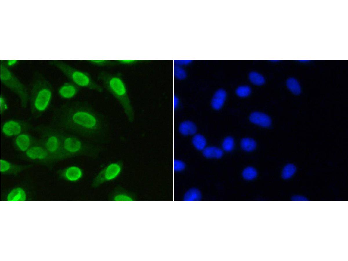 ICC staining Histone H3(mono methyl K36) in MCF-7 cells (green). The nuclear counter stain is DAPI (blue). Cells were fixed in paraformaldehyde, permeabilised with 0.25% Triton X100/PBS.