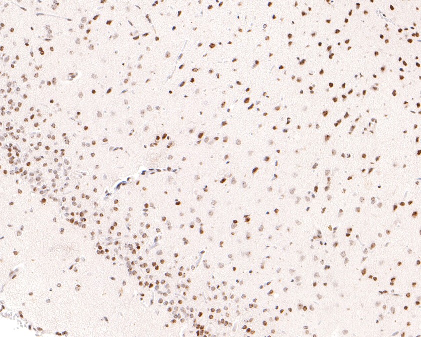 Immunohistochemical analysis of paraffin-embedded human kidney tissue using anti-Brd4 antibody. The section was pre-treated using heat mediated antigen retrieval with sodium citrate buffer (pH 6.0) for 20 minutes. The tissues were blocked in 1% BSA for 30 minutes at room temperature, washed with ddH2O and PBS, and then probed with the primary antibody (ER1901-02, 1/600)  for 30 minutes at room temperature. The detection was performed using an HRP conjugated compact polymer system. DAB was used as the chromogen. Tissues were counterstained with hematoxylin and mounted with DPX.