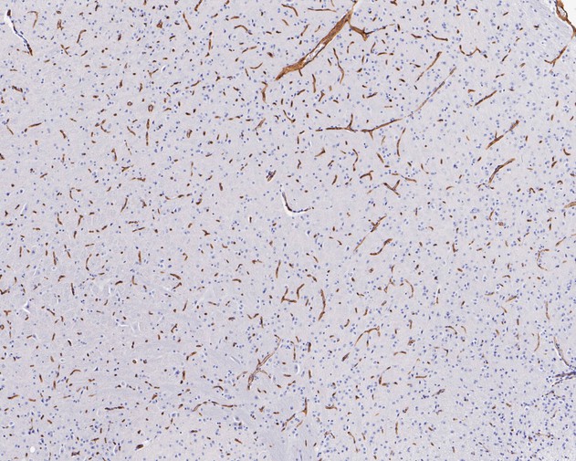 Immunohistochemical analysis of paraffin-embedded rat brain tissue using anti-P Glycoprotein antibody. The section was pre-treated using heat mediated antigen retrieval with Tris-EDTA buffer (pH 8.0-8.4) for 20 minutes.The tissues were blocked in 5% BSA for 30 minutes at room temperature, washed with ddH2O and PBS, and then probed with the primary antibody (ET1611-30, 1/200) for 30 minutes at room temperature. The detection was performed using an HRP conjugated compact polymer system. DAB was used as the chromogen. Tissues were counterstained with hematoxylin and mounted with DPX.