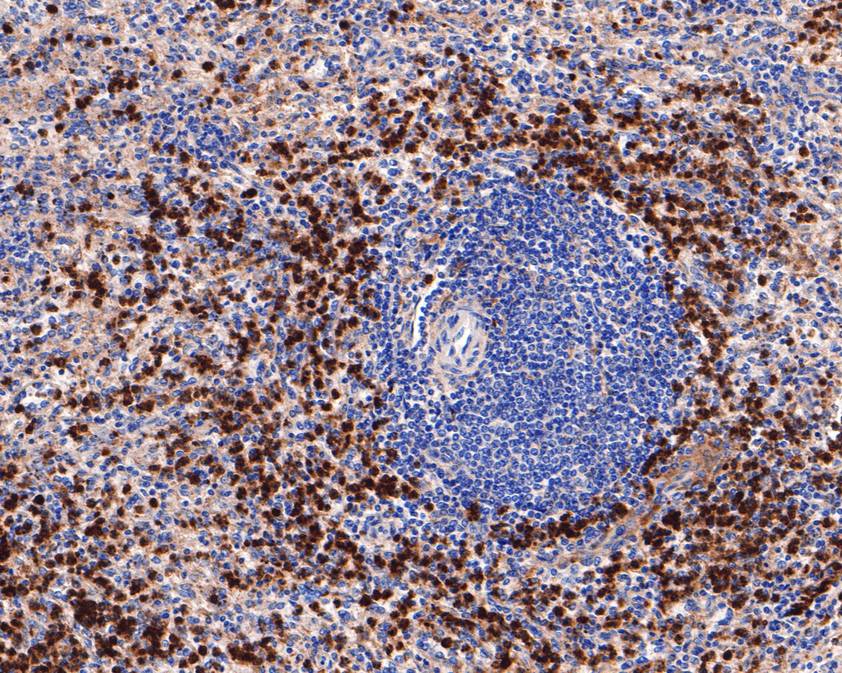 Immunohistochemical analysis of paraffin-embedded human spleen tissue using anti-CD63 antibody. The section was pre-treated using heat mediated antigen retrieval with Tris-EDTA buffer (pH 8.0-8.4) for 20 minutes.The tissues were blocked in 5% BSA for 30 minutes at room temperature, washed with ddH2O and PBS, and then probed with the primary antibody (ET1607-2, 1/400) for 30 minutes at room temperature. The detection was performed using an HRP conjugated compact polymer system. DAB was used as the chromogen. Tissues were counterstained with hematoxylin and mounted with DPX.