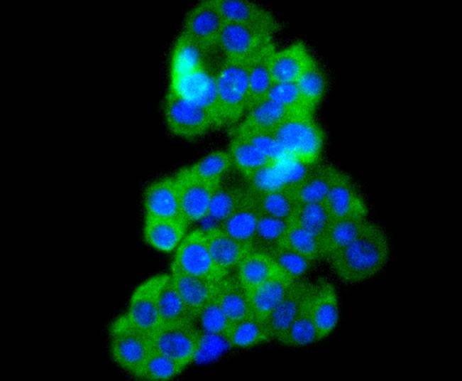 ICC staining of Phospho-B Raf(T401) in PC-12 cells (green). Formalin fixed cells were permeabilized with 0.1% Triton X-100 in TBS for 10 minutes at room temperature and blocked with 10% negative goat serum for 15 minutes at room temperature. Cells were probed with the primary antibody (ET1701-20, 1/50) for 1 hour at room temperature, washed with PBS. Alexa Fluor®488 conjugate-Goat anti-Rabbit IgG was used as the secondary antibody at 1/1,000 dilution. The nuclear counter stain is DAPI (blue).