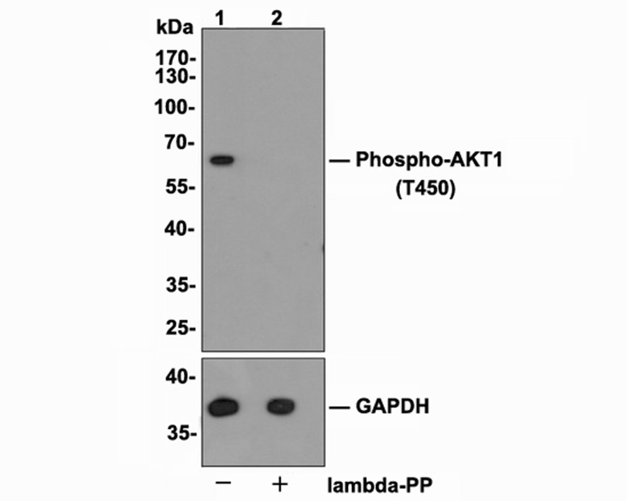 Western blot analysis of Phospho-AKT1 (T450) on MCF-7 cell lysates.<br />
<br />
Lane 1: MCF-7 cells, whole cell lysate, 10 ug/lane.<br />
Lane 2: MCF-7 cells treated with 2.8 μg/ul lambda-PP for 30 minutes, whole cell lysates, 10 ug/lane.<br />
<br />
Proteins were transferred to a PVDF membrane and blocked with 5% BSA in PBS for 1 hour at room temperature. The primary antibody Anti-Phospho-AKT1 (T450) antibody (ET1612-73, 1/1,000) , Anti-AKT1 antibody (ET1609-47, 1/5,000) and Anti-GAPDH antibody (ET1601-4, 1/10,000)was used in 5% BSA at room temperature for 2 hours. Goat Anti-Rabbit IgG H&L (HRP) Secondary Antibody (HA1001) at 1:200,000 dilution was used for 1 hour at room temperature.<br />
<br />
Predicted band size: 56 kDa<br />
Observed band size: 60 kDa<br />
<br />
Exposure time: 2 minutes