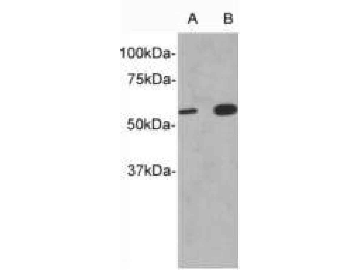 Western blot analysis on D3 (A) and HepG2 (B) using anti IL13Ra1 polyclonal antibody.