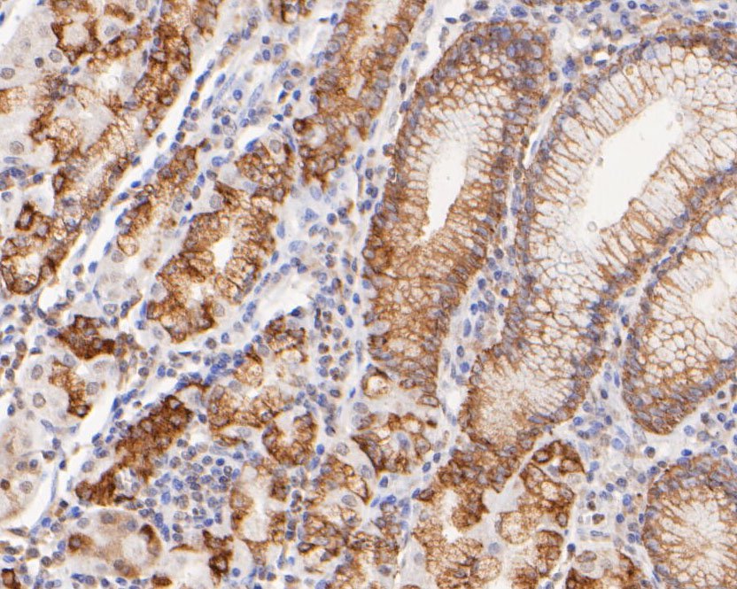 Immunohistochemical analysis of paraffin-embedded human Stomach tissue using anti-FAT1 antibody. The section was pre-treated using heat mediated antigen retrieval with sodium citrate buffer (pH 6.0) for 20 minutes. The tissues were blocked in 5% BSA for 30 minutes at room temperature, washed with ddH2O and PBS, and then probed with the primary antibody (0905-4, 1/100) for 1 hour at room temperature. The detection was performed using an HRP conjugated compact polymer system. DAB was used as the chromogen. Tissues were counterstained with hematoxylin and mounted with DPX.