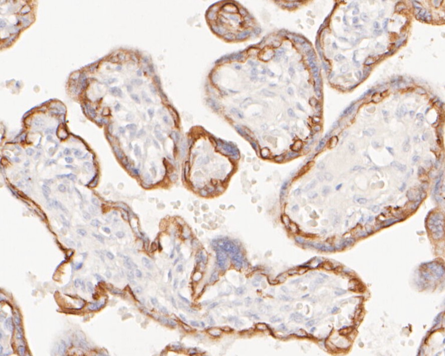 Immunohistochemical analysis of paraffin-embedded human liver tissue using anti-Cytokeratin 7 antibody. The section was pre-treated using heat mediated antigen retrieval with Tris-EDTA buffer (pH 9.0) for 20 minutes.The tissues were blocked in 5% BSA for 30 minutes at room temperature, washed with ddH2O and PBS, and then probed with the primary antibody (ET1609-62, 1/200) for 30 minutes at room temperature. The detection was performed using an HRP conjugated compact polymer system. DAB was used as the chromogen. Tissues were counterstained with hematoxylin and mounted with DPX.