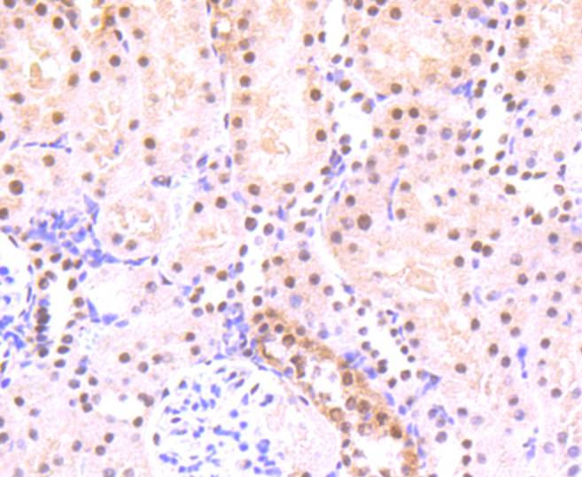 Immunohistochemical analysis of paraffin-embedded rat kidney tissue using anti-Phospho-STAT3 (S727) antibody. The section was pre-treated using heat mediated antigen retrieval with Tris-EDTA buffer (pH 8.0-8.4) for 20 minutes.The tissues were blocked in 5% BSA for 30 minutes at room temperature, washed with ddH2O and PBS, and then probed with the primary antibody (ET1607-39, 1/50) for 30 minutes at room temperature. The detection was performed using an HRP conjugated compact polymer system. DAB was used as the chromogen. Tissues were counterstained with hematoxylin and mounted with DPX.