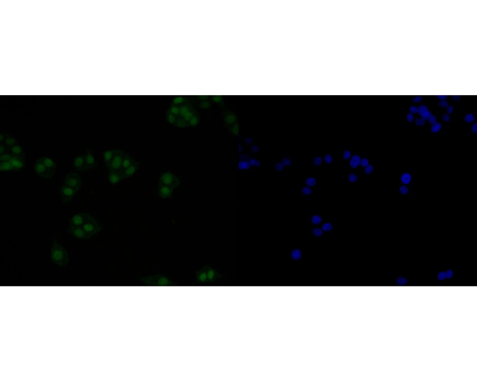 ICC staining of HMGB2 in PC-12 cells (green). Formalin fixed cells were permeabilized with 0.1% Triton X-100 in TBS for 10 minutes at room temperature and blocked with 10% negative goat serum for 15 minutes at room temperature. Cells were probed with the primary antibody (HA500512, 1/50) for 1 hour at room temperature, washed with PBS. Alexa Fluor®488 Goat anti-Rabbit IgG was used as the secondary antibody at 1/1,000 dilution. The nuclear counter stain is DAPI (blue).