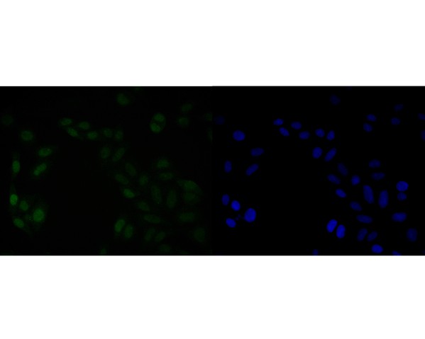ICC staining of HMGB2 in SiHa cells (green). Formalin fixed cells were permeabilized with 0.1% Triton X-100 in TBS for 10 minutes at room temperature and blocked with 10% negative goat serum for 15 minutes at room temperature. Cells were probed with the primary antibody (HA500512, 1/50) for 1 hour at room temperature, washed with PBS. Alexa Fluor®488 Goat anti-Rabbit IgG was used as the secondary antibody at 1/1,000 dilution. The nuclear counter stain is DAPI (blue).