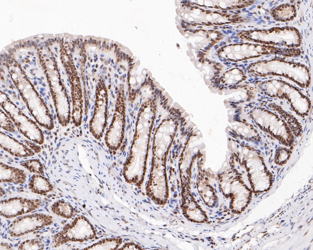 Immunohistochemical analysis of paraffin-embedded rat large intestine tissue using anti-HMGB2 antibody. The section was pre-treated using heat mediated antigen retrieval with sodium citrate buffer (pH 6.0) for 20 minutes. The tissues were blocked in 5% BSA for 30 minutes at room temperature, washed with ddH2O and PBS, and then probed with the primary antibody (HA500512, 1/200)  for 30 minutes at room temperature. The detection was performed using an HRP conjugated compact polymer system. DAB was used as the chromogen. Tissues were counterstained with hematoxylin and mounted with DPX.