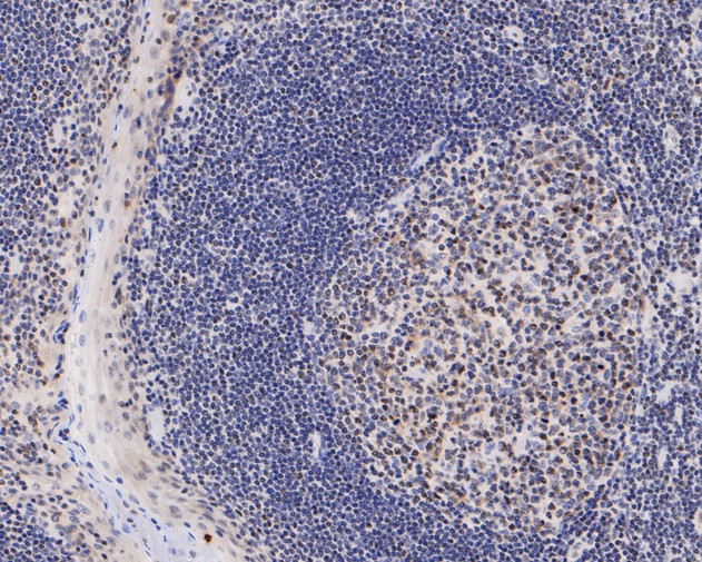 Immunohistochemical analysis of paraffin-embedded human tonsil tissue using anti-HMGB2 antibody. The section was pre-treated using heat mediated antigen retrieval with sodium citrate buffer (pH 6.0) for 20 minutes. The tissues were blocked in 5% BSA for 30 minutes at room temperature, washed with ddH2O and PBS, and then probed with the primary antibody (HA500512, 1/200)  for 30 minutes at room temperature. The detection was performed using an HRP conjugated compact polymer system. DAB was used as the chromogen. Tissues were counterstained with hematoxylin and mounted with DPX.
