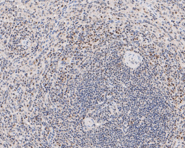 Immunohistochemical analysis of paraffin-embedded human spleen tissue using anti-HMGB2 antibody. The section was pre-treated using heat mediated antigen retrieval with sodium citrate buffer (pH 6.0) for 20 minutes. The tissues were blocked in 5% BSA for 30 minutes at room temperature, washed with ddH2O and PBS, and then probed with the primary antibody (HA500512, 1/50)  for 30 minutes at room temperature. The detection was performed using an HRP conjugated compact polymer system. DAB was used as the chromogen. Tissues were counterstained with hematoxylin and mounted with DPX.