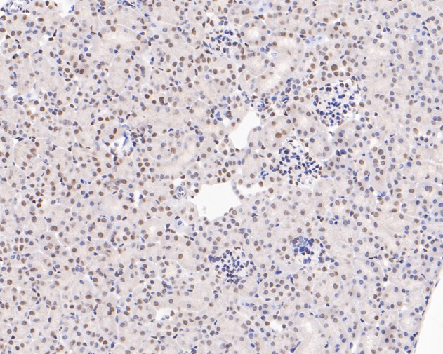 Immunohistochemical analysis of paraffin-embedded mouse kidney tissue using anti-HMGB2 antibody. The section was pre-treated using heat mediated antigen retrieval with sodium citrate buffer (pH 6.0) for 20 minutes. The tissues were blocked in 5% BSA for 30 minutes at room temperature, washed with ddH2O and PBS, and then probed with the primary antibody (HA500512, 1/200)  for 30 minutes at room temperature. The detection was performed using an HRP conjugated compact polymer system. DAB was used as the chromogen. Tissues were counterstained with hematoxylin and mounted with DPX.