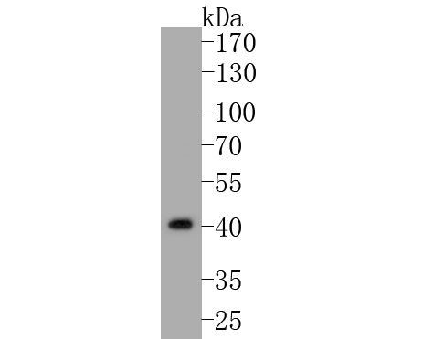 Western blot analysis of B3GAT1 on rat brain tissue lysates. Proteins were transferred to a PVDF membrane and blocked with 5% NFDM/TBST. for 1 hour at room temperature. The primary antibody (HA500443, 1/500) was used in 5% NFDM/TBST. at room temperature for 2 hours. Goat Anti-Rabbit IgG - HRP Secondary Antibody (HA1001) at 1:5,000 dilution was used for 1 hour at room temperature.