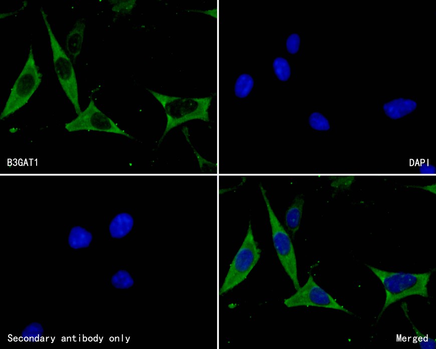 ICC staining of B3GAT1 in SH-SY5Y cells (green). Formalin fixed cells were permeabilized with 0.1% Triton X-100 in TBS for 10 minutes at room temperature and blocked with 10% negative goat serum for 15 minutes at room temperature. Cells were probed with the primary antibody (HA500443, 1/50) for 1 hour at room temperature, washed with PBS. Alexa Fluor®488 conjugate-Goat anti-Rabbit IgG was used as the secondary antibody at 1/1,000 dilution. The nuclear counter stain is DAPI (blue).
