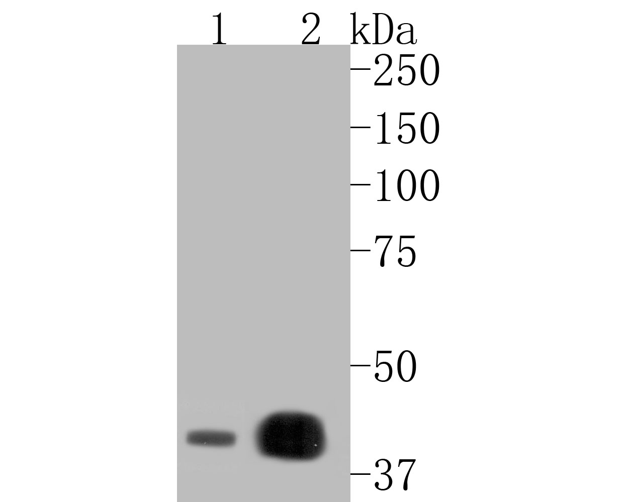 Western blot analysis of HMGCS2 on different lysates. Proteins were transferred to a PVDF membrane and blocked with 5% NFDM/TBST for 1 hour at room temperature. The primary antibody (HA720083, 1/1,000) was used in 5% NFDM/TBST at room temperature for 2 hours. Goat Anti-Rabbit IgG - HRP Secondary Antibody (HA1001) at 1:5,000 dilution was used for 1 hour at room temperature.<br />
Positive control: <br />
Lane 1: human kidney tissue lysate<br />
Lane 2: mouse liver tissue lysate<br />
<br />
Predicted band size: 56 kDa<br />
Observed band size: 45 kDa