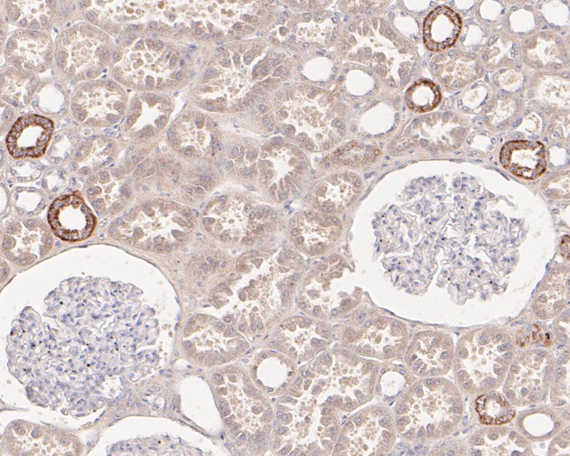 Immunohistochemical analysis of paraffin-embedded human kidney tissue using anti-HMGCS2 antibody. The section was pre-treated using heat mediated antigen retrieval with Tris-EDTA buffer (pH 8.0-8.4) for 20 minutes.The tissues were blocked in 5% BSA for 30 minutes at room temperature, washed with ddH2O and PBS, and then probed with the primary antibody (HA720083, 1/50) for 30 minutes at room temperature. The detection was performed using an HRP conjugated compact polymer system. DAB was used as the chromogen. Tissues were counterstained with hematoxylin and mounted with DPX.