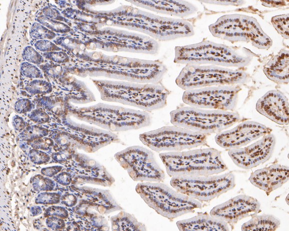 Immunohistochemical analysis of paraffin-embedded mouse colon cancer tissue using anti-Histone H3 antibody. The section was pre-treated using heat mediated antigen retrieval with sodium citrate buffer (pH 6.0) for 20 minutes. The tissues were blocked in 5% BSA for 30 minutes at room temperature, washed with ddH2O and PBS, and then probed with the primary antibody (HA500298, 1/400)  for 30 minutes at room temperature. The detection was performed using an HRP conjugated compact polymer system. DAB was used as the chromogen. Tissues were counterstained with hematoxylin and mounted with DPX.