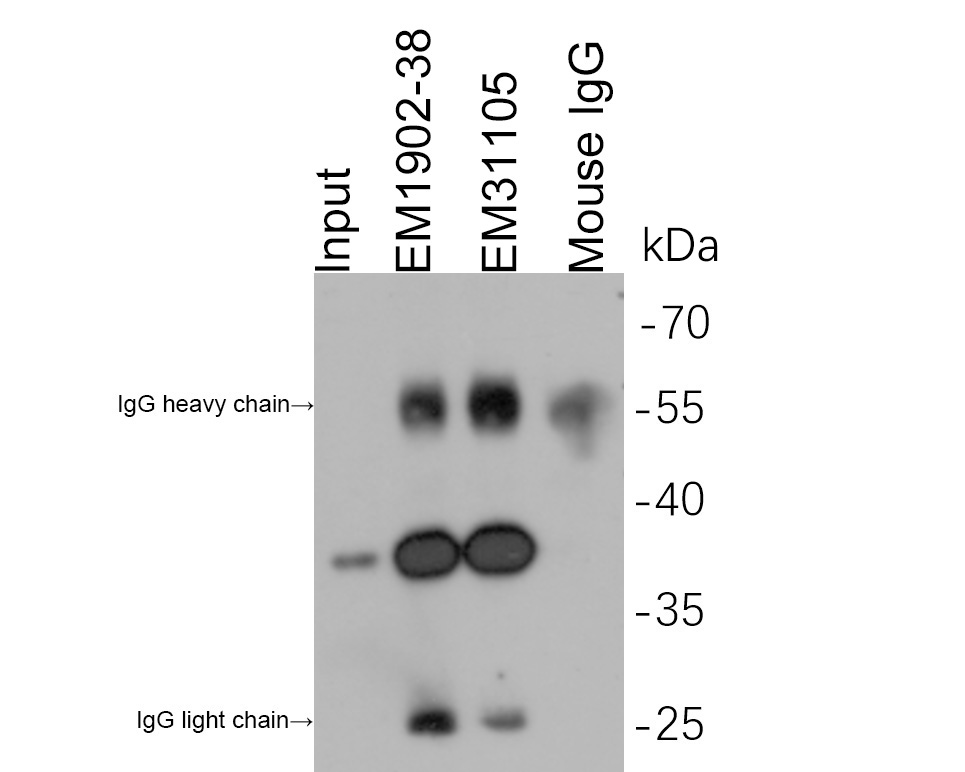 Myc tag was immunoprecipitated in 2µg N terminal Myc Tag fusion protein lysate with EM1902-38 at 2 µg/20 µl agarose. Western blot was performed from the immunoprecipitate using R1208-1 at 1/1,000 dilution. Anti-Rabbit IgG - HRP Secondary Antibody (HA1001) at 1:200,000 dilution was used for 60 mins at room temperature.<br />
<br />
Lane 1: Myc Tag fusion protein lysate (input).<br />
Lane 2: EM1902-38 IP in Myc Tag fusion protein lysate.<br />
Lane 3: EM31105 IP in Myc Tag fusion protein lysate.<br />
Lane 4: Mouse IgG instead of EM1902-38 in Myc Tag fusion protein lysate.<br />
<br />
Blocking/Dilution buffer: 5% NFDM/TBST