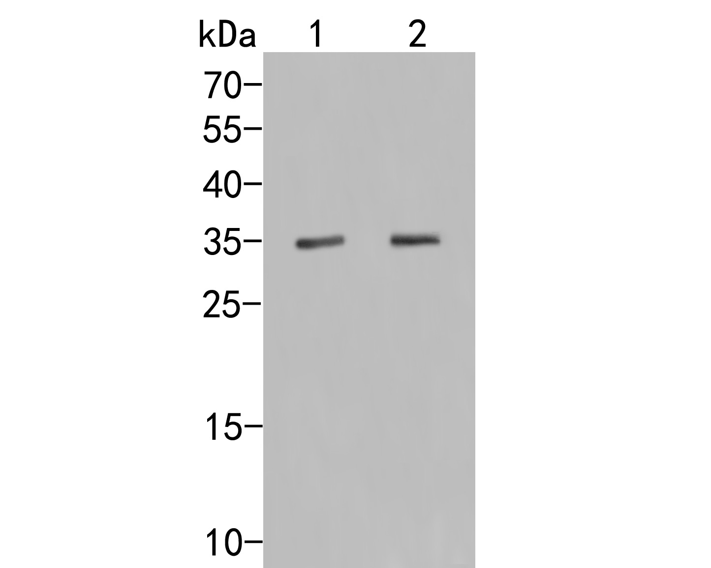 Western blot analysis of Osteopontin on different lysates. Proteins were transferred to a PVDF membrane and blocked with 5% NFDM/TBST for 1 hour at room temperature. The primary antibody (HA500464, 1/500) was used in 5% NFDM/TBST at room temperature for 2 hours. Goat Anti-Rabbit IgG - HRP Secondary Antibody (HA1001) at 1:5,000 dilution was used for 1 hour at room temperature.<br />
Positive control: <br />
Lane 1: Mouse liver tissue lysate<br />
Lane 2: HepG2 cell lysate
