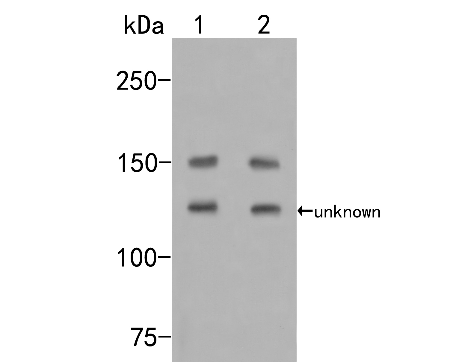 Western blot analysis of Flightless 1 on different lysates. Proteins were transferred to a PVDF membrane and blocked with 5% NFDM/TBST for 1 hour at room temperature. The primary antibody (HA500167, 1/500) was used in 5% NFDM/TBST at room temperature for 2 hours. Goat Anti-Rabbit IgG - HRP Secondary Antibody (HA1001) at 1:200,000 dilution was used for 1 hour at room temperature.<br />
Positive control: <br />
Lane 1: Mouse lung tissue lysate<br />
Lane 2: MCF-7 cell lysate