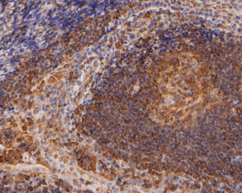Immunohistochemical analysis of paraffin-embedded human tonsil  tissue using anti-Flightless 1 antibody. The section was pre-treated using heat mediated antigen retrieval with sodium citrate buffer (pH 6.0) for 20 minutes. The tissues were blocked in 5% BSA for 30 minutes at room temperature, washed with ddH2O and PBS, and then probed with the primary antibody (HA500167, 1/400)  for 30 minutes at room temperature. The detection was performed using an HRP conjugated compact polymer system. DAB was used as the chromogen. Tissues were counterstained with hematoxylin and mounted with DPX.