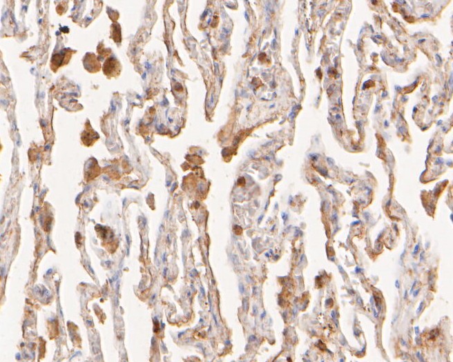 Immunohistochemical analysis of paraffin-embedded human lung tissue using anti-Flightless 1 antibody. The section was pre-treated using heat mediated antigen retrieval with sodium citrate buffer (pH 6.0) for 20 minutes. The tissues were blocked in 5% BSA for 30 minutes at room temperature, washed with ddH2O and PBS, and then probed with the primary antibody (HA500167, 1/400)  for 30 minutes at room temperature. The detection was performed using an HRP conjugated compact polymer system. DAB was used as the chromogen. Tissues were counterstained with hematoxylin and mounted with DPX.