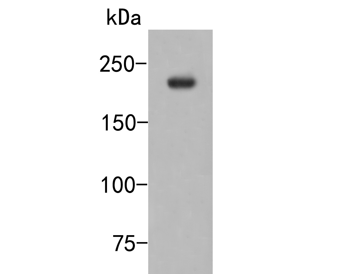 Western blot analysis of CNOT1 on rat brain tissue lysates. Proteins were transferred to a PVDF membrane and blocked with 5% NFDM/TBST for 1 hour at room temperature. The primary antibody (HA500466, 1/500) was used in 5% NFDM/TBST at room temperature for 2 hours. Goat Anti-Rabbit IgG - HRP Secondary Antibody (HA1001) at 1:200,000 dilution was used for 1 hour at room temperature.