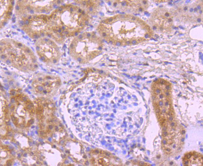 Immunohistochemical analysis of paraffin-embedded rat kidney tissue using anti-NADPH oxidase 4/NOX4 antibody. The section was pre-treated using heat mediated antigen retrieval with Tris-EDTA buffer (pH 9.0) for 20 minutes.The tissues were blocked in 1% BSA for 30 minutes at room temperature, washed with ddH2O and PBS, and then probed with the primary antibody (ET1607-4, 1/50) for 30 minutes at room temperature. The detection was performed using an HRP conjugated compact polymer system. DAB was used as the chromogen. Tissues were counterstained with hematoxylin and mounted with DPX.