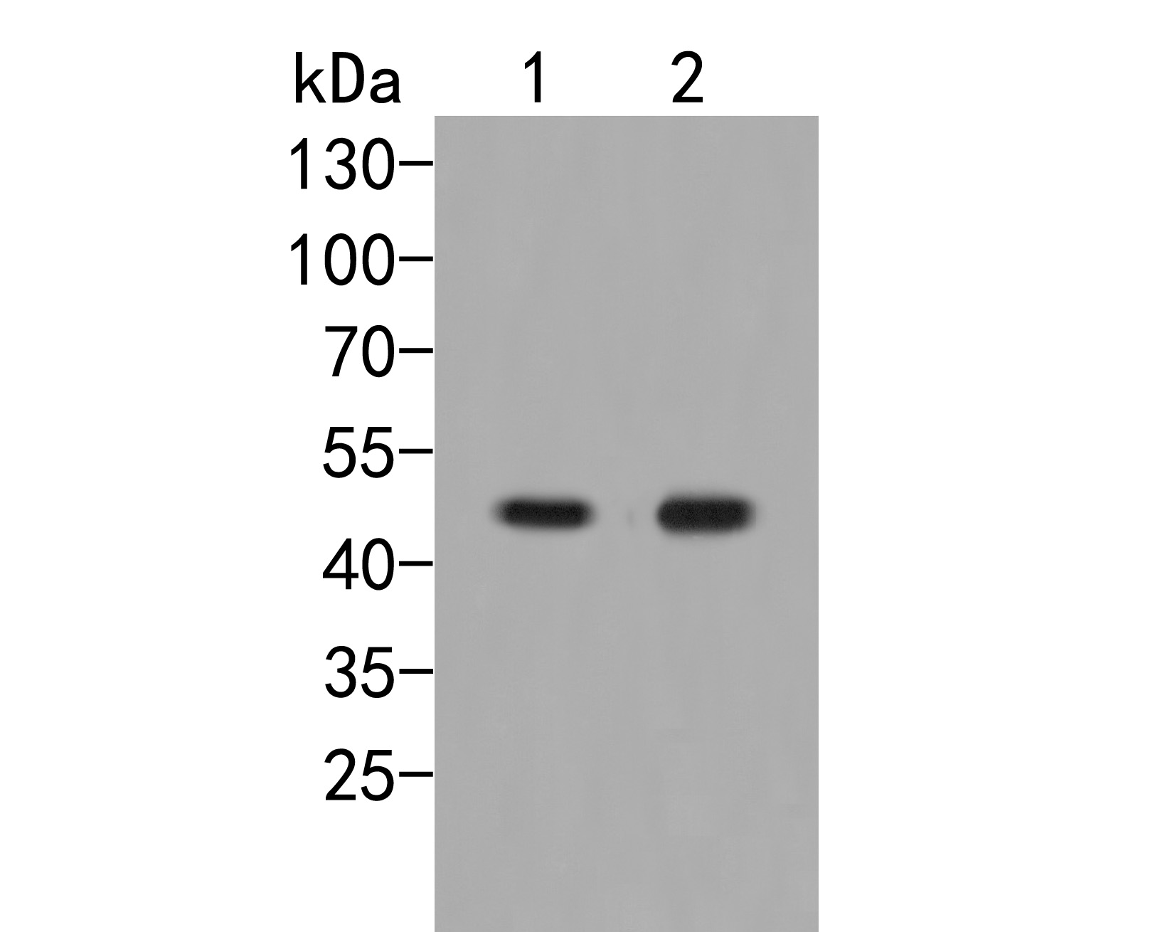 Western blot analysis of EEF1G on different lysates. Proteins were transferred to a PVDF membrane and blocked with 5% NFDM/TBST for 1 hour at room temperature. The primary antibody (HA500258, 1/500) was used in 5% NFDM/TBST at room temperature for 2 hours. Goat Anti-Rabbit IgG - HRP Secondary Antibody (HA1001) at 1:20,000 dilution was used for 1 hour at room temperature.<br />
Positive control: <br />
Lane 1: Daudi cell lysate<br />
Lane 2: NIH/3T3 cell lysate