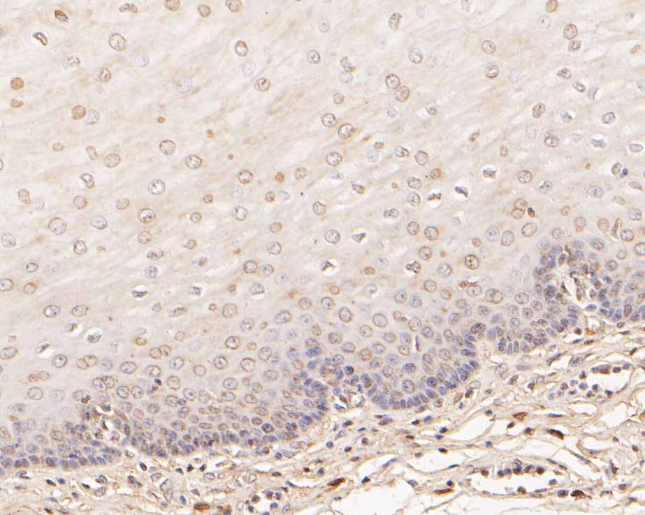 Immunohistochemical analysis of paraffin-embedded human esophagus tissue using anti-EEF1G antibody. The section was pre-treated using heat mediated antigen retrieval with Tris-EDTA buffer (pH 9.0) for 20 minutes.The tissues were blocked in 5% BSA for 30 minutes at room temperature, washed with ddH2O and PBS, and then probed with the primary antibody (HA500258, 1/800) for 30 minutes at room temperature. The detection was performed using an HRP conjugated compact polymer system. DAB was used as the chromogen. Tissues were counterstained with hematoxylin and mounted with DPX.