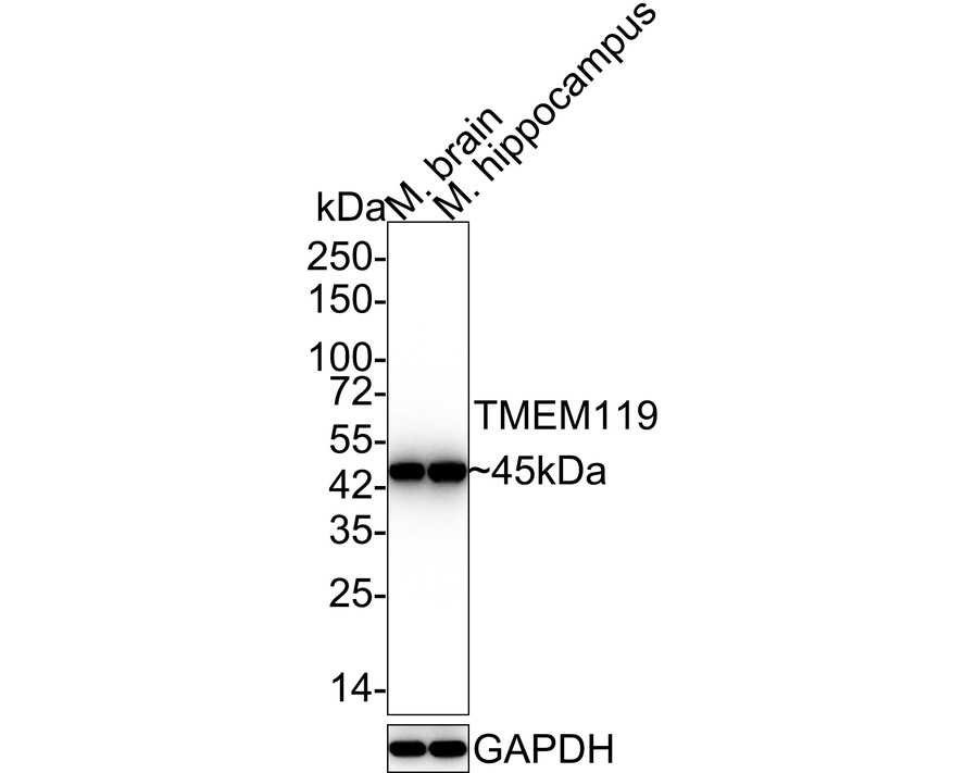 Western blot analysis of TMEM119 on different lysates with Rabbit anti-TMEM119 antibody (HA500260) at 1/2,000 dilution.<br />
<br />
Lane 1: Mouse brain tissue lysate<br />
Lane 2: Mouse cerebellum tissue lysate<br />
<br />
Lysates/proteins at 20 µg/Lane.<br />
<br />
Predicted band size: 29 kDa<br />
Observed band size: 45 kDa<br />
<br />
Exposure time: 2 minutes;<br />
<br />
12% SDS-PAGE gel.<br />
<br />
Proteins were transferred to a PVDF membrane and blocked with 5% NFDM/TBST for 1 hour at room temperature. The primary antibody (HA500260) at 1/2,000 dilution was used in 5% NFDM/TBST at room temperature for 2 hours. Goat Anti-Rabbit IgG - HRP Secondary Antibody (HA1001) at 1:300,000 dilution was used for 1 hour at room temperature.