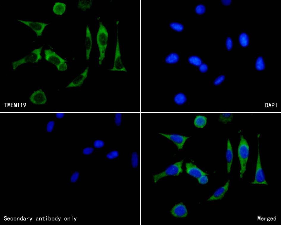 ICC staining of TMEM119 in SH-SY5Y cells (green). Formalin fixed cells were permeabilized with 0.1% Triton X-100 in TBS for 10 minutes at room temperature and blocked with 10% negative goat serum for 15 minutes at room temperature. Cells were probed with the primary antibody (HA500260, 1/50) for 1 hour at room temperature, washed with PBS. Alexa Fluor®488 conjugate-Goat anti-Rabbit IgG was used as the secondary antibody at 1/1,000 dilution. The nuclear counter stain is DAPI (blue).