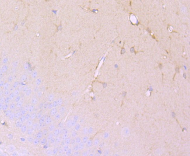 Immunohistochemical analysis of paraffin-embedded mouse brain tissue using anti-DCAMKL1 antibody. The section was pre-treated using heat mediated antigen retrieval with Tris-EDTA buffer (pH 9.0) for 20 minutes.The tissues were blocked in 5% BSA for 30 minutes at room temperature, washed with ddH2O and PBS, and then probed with the primary antibody (ET1704-10, 1/50) for 30 minutes at room temperature. The detection was performed using an HRP conjugated compact polymer system. DAB was used as the chromogen. Tissues were counterstained with hematoxylin and mounted with DPX.
