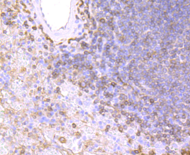 Immunohistochemical analysis of paraffin-embedded human spleen tissue using anti-MHC Class II antibody. The section was pre-treated using heat mediated antigen retrieval with Tris-EDTA buffer (pH 9.0) for 20 minutes.The tissues were blocked in 5% BSA for 30 minutes at room temperature, washed with ddH2O and PBS, and then probed with the primary antibody (ET1704-13, 1/50) for 30 minutes at room temperature. The detection was performed using an HRP conjugated compact polymer system. DAB was used as the chromogen. Tissues were counterstained with hematoxylin and mounted with DPX.