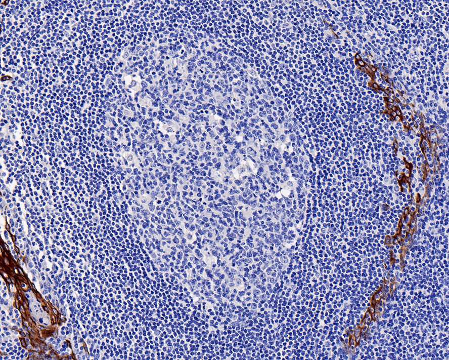 Immunohistochemical analysis of paraffin-embedded human tonsil tissue using anti-IP10 antibody. The section was pre-treated using heat mediated antigen retrieval with Tris-EDTA buffer (pH 9.0) for 20 minutes.The tissues were blocked in 1% BSA for 30 minutes at room temperature, washed with ddH2O and PBS, and then probed with the primary antibody (ET1704-27, 1/400) for 30 minutes at room temperature. The detection was performed using an HRP conjugated compact polymer system. DAB was used as the chromogen. Tissues were counterstained with hematoxylin and mounted with DPX.