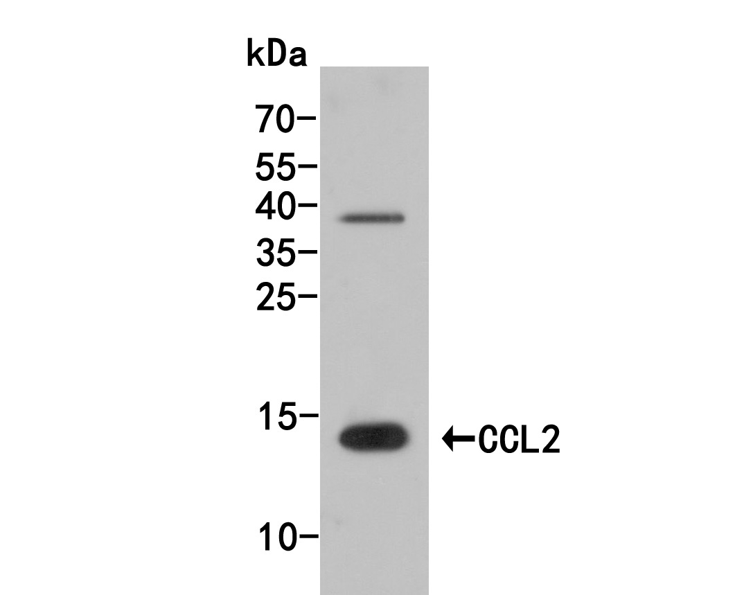 Western blot analysis of CCL2 on mouse testis tissue lysate. Proteins were transferred to a PVDF membrane and blocked with 5% NFDM/TBST for 1 hour at room temperature. The primary antibody (HA500267, 1/500) was used in 5% NFDM/TBST at room temperature for 2 hours. Goat Anti-Rabbit IgG - HRP Secondary Antibody (HA1001) at 1:200,000 dilution was used for 1 hour at room temperature.