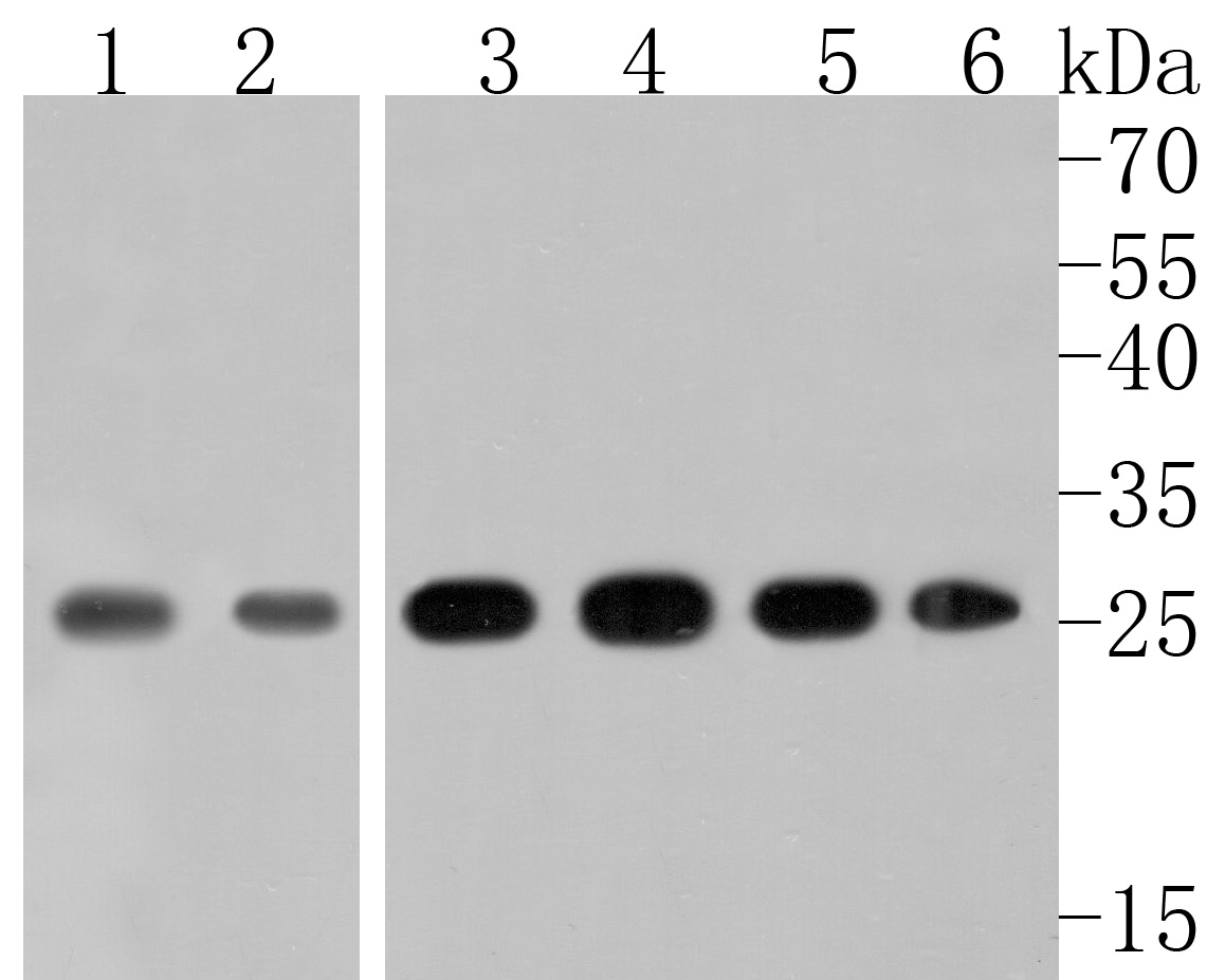 Western blot analysis of Triosephosphate isomerase on different lysates. Proteins were transferred to a PVDF membrane and blocked with 5% NFDM/TBST for 1 hour at room temperature. The primary antibody (HA500283, 1/1,000) was used in 5% NFDM/TBST at room temperature for 2 hours. Goat Anti-Rabbit IgG - HRP Secondary Antibody (HA1001) at 1:200,000 dilution was used for 1 hour at room temperature.<br />
Positive control: <br />
Lane 1: Rat brain tissue lysate<br />
Lane 2: 293 cell lysate<br />
Lane 3: HepG2 cell lysate<br />
Lane 4: Rat skeletal muscle tissue lysate<br />
Lane 5: Mouse skeletal muscle tissue lysate<br />
Lane 6: Mouse lung tissue lysate<br />
<br />
Predicted band size: 27 kDa<br />
Observed band size: 27 kDa