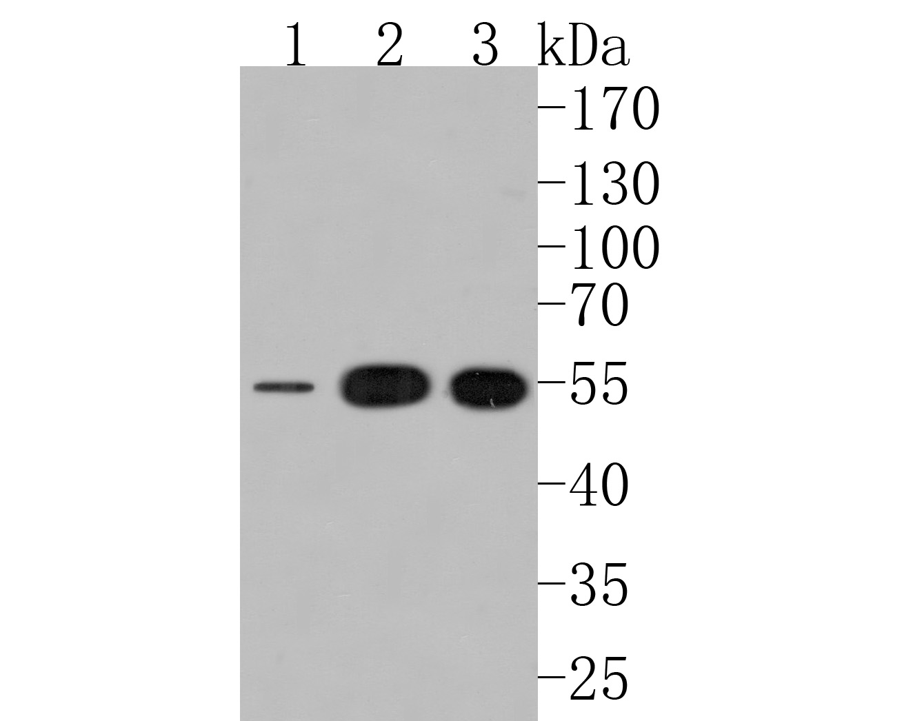 Western blot analysis of Adipose Triglyceride Lipase on different lysates. Proteins were transferred to a PVDF membrane and blocked with 5% NFDM/TBST for 1 hour at room temperature. The primary antibody (HA500301, 1/1,000) was used in 5% NFDM/TBST at room temperature for 2 hours. Goat Anti-Rabbit IgG - HRP Secondary Antibody (HA1001) at 1:200,000 dilution was used for 1 hour at room temperature.<br />
Positive control: <br />
Lane 1: 293 cell lysate<br />
Lane 2: HepG2 cell lysate<br />
Lane 3: A431 cell lysate