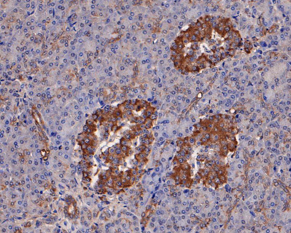 Immunohistochemical analysis of paraffin-embedded human pancreas tissue using anti-Adipose Triglyceride Lipase antibody. The section was pre-treated using heat mediated antigen retrieval with Tris-EDTA buffer (pH 9.0) for 20 minutes.The tissues were blocked in 5% BSA for 30 minutes at room temperature, washed with ddH2O and PBS, and then probed with the primary antibody (HA500301, 1/100) for 30 minutes at room temperature. The detection was performed using an HRP conjugated compact polymer system. DAB was used as the chromogen. Tissues were counterstained with hematoxylin and mounted with DPX.