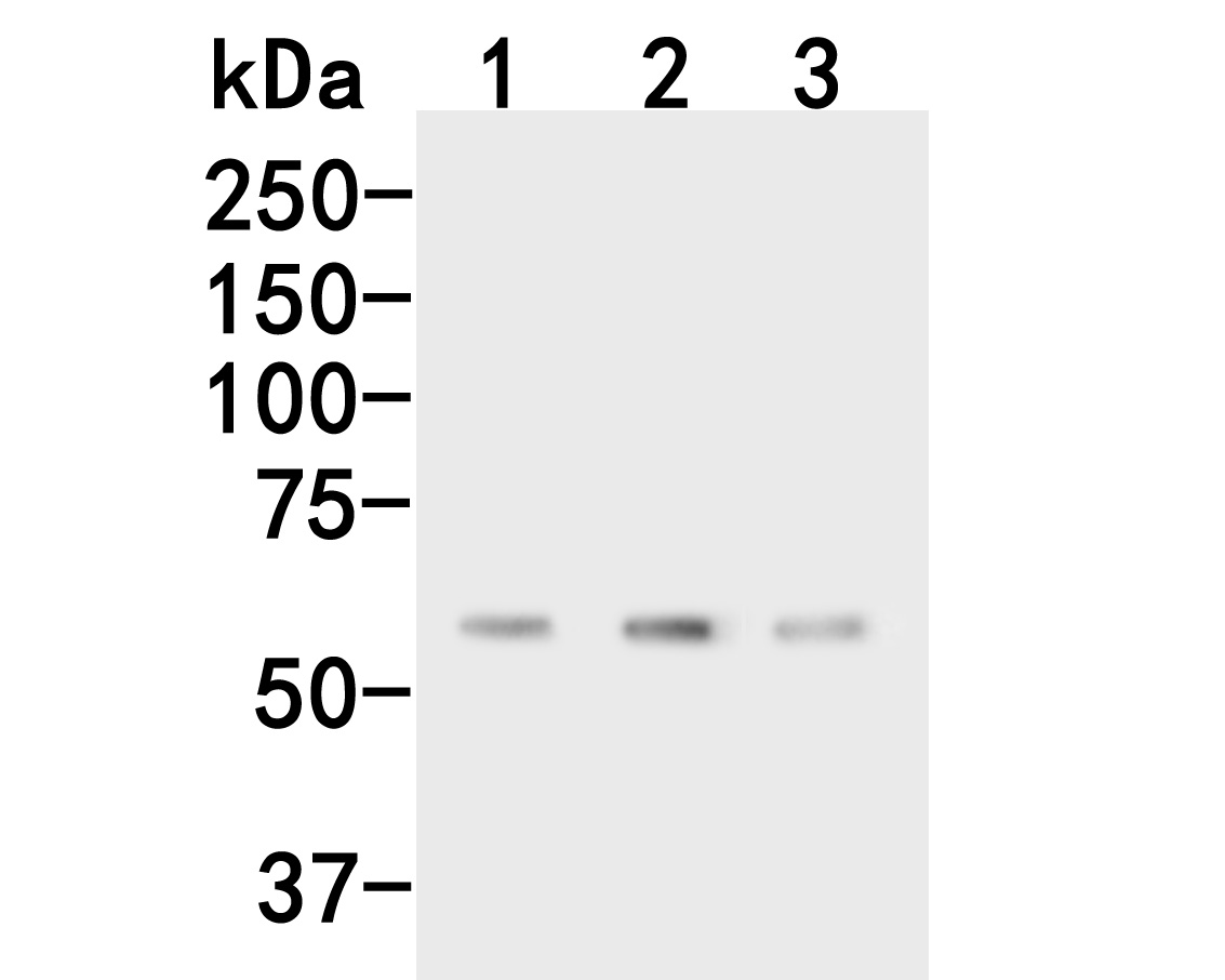 Western blot analysis of CPN1 on different lysates. Proteins were transferred to a PVDF membrane and blocked with 5% NFDM/TBST for 1 hour at room temperature. The primary antibody (HA500462, 1/500) was used in 5% NFDM/TBST at room temperature for 2 hours. Goat Anti-Rabbit IgG - HRP Secondary Antibody (HA1001) at 1:200,000 dilution was used for 1 hour at room temperature.<br />
Positive control: <br />
Lane 1: Hela cell lysate<br />
Lane 2: Raji cell lysate<br />
Lane 3: Mouse pancreas tissue lysate<br />
<br />
Predicted band size: 52 kDa<br />
Observed band size: 55 kDa