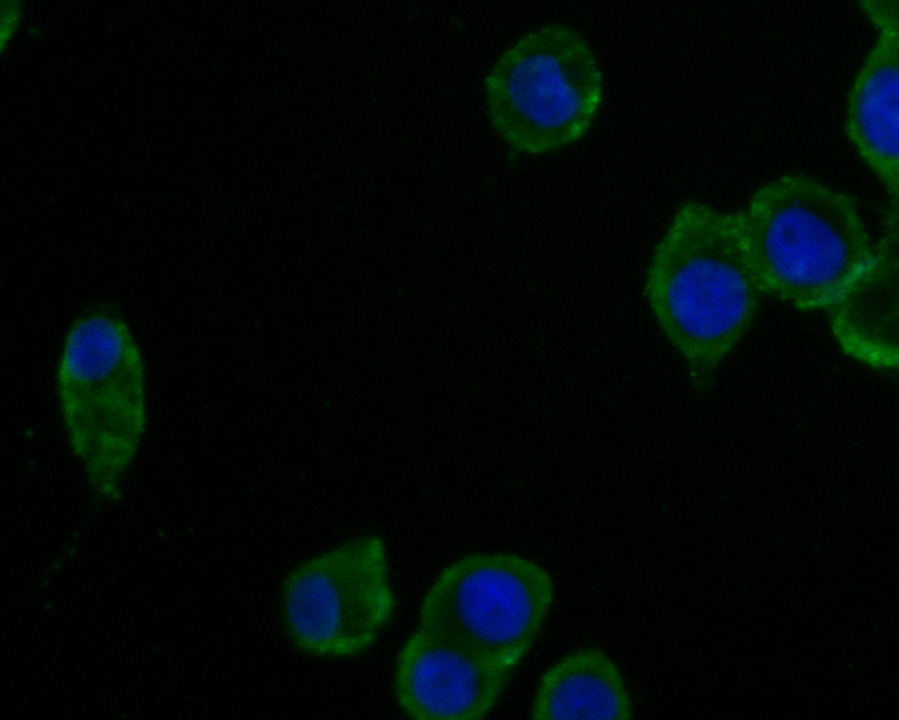 ICC staining of CPN1 in LOVO cells (green). Formalin fixed cells were permeabilized with 0.1% Triton X-100 in TBS for 10 minutes at room temperature and blocked with 1% Blocker BSA for 15 minutes at room temperature. Cells were probed with the primary antibody (HA500462, 1/100) for 1 hour at room temperature, washed with PBS. Alexa Fluor®488 Goat anti-Rabbit IgG was used as the secondary antibody at 1/1,000 dilution. The nuclear counter stain is DAPI (blue).