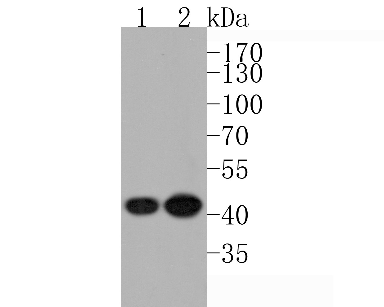 Western blot analysis of TEF1 on different lysates. Proteins were transferred to a PVDF membrane and blocked with 5% NFDM/TBST for 1 hour at room temperature. The primary antibody (HA500277, 1/500) was used in 5% NFDM/TBST at room temperature for 2 hours. Goat Anti-Rabbit IgG - HRP Secondary Antibody (HA1001) at 1:200,000 dilution was used for 1 hour at room temperature.<br />
Positive control: <br />
Lane 1: Mouse liver tissue lysate<br />
Lane 2: Mouse skeletal muscle tissue lysate<br />
<br />
Predicted band size: 48 kDa<br />
Observed band size: 43 kDa
