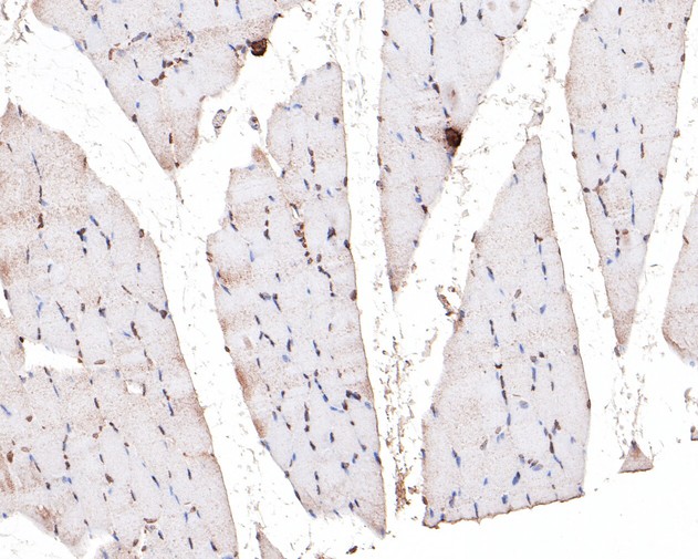 Immunohistochemical analysis of paraffin-embedded rat skeletal muscle tissue using anti-TEF1 antibody. The section was pre-treated using heat mediated antigen retrieval with sodium citrate buffer (pH 6.0) for 20 minutes. The tissues were blocked in 5% BSA for 30 minutes at room temperature, washed with ddH2O and PBS, and then probed with the primary antibody (HA500277, 1/400)  for 30 minutes at room temperature. The detection was performed using an HRP conjugated compact polymer system. DAB was used as the chromogen. Tissues were counterstained with hematoxylin and mounted with DPX.