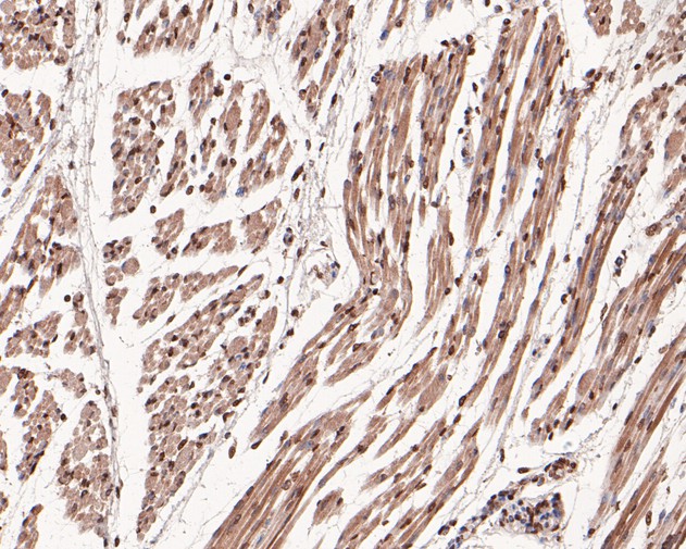 Immunohistochemical analysis of paraffin-embedded human fetal skeletal muscle tissue using anti-TEF1 antibody. The section was pre-treated using heat mediated antigen retrieval with sodium citrate buffer (pH 6.0) for 20 minutes. The tissues were blocked in 5% BSA for 30 minutes at room temperature, washed with ddH2O and PBS, and then probed with the primary antibody (HA500277, 1/400)  for 30 minutes at room temperature. The detection was performed using an HRP conjugated compact polymer system. DAB was used as the chromogen. Tissues were counterstained with hematoxylin and mounted with DPX.
