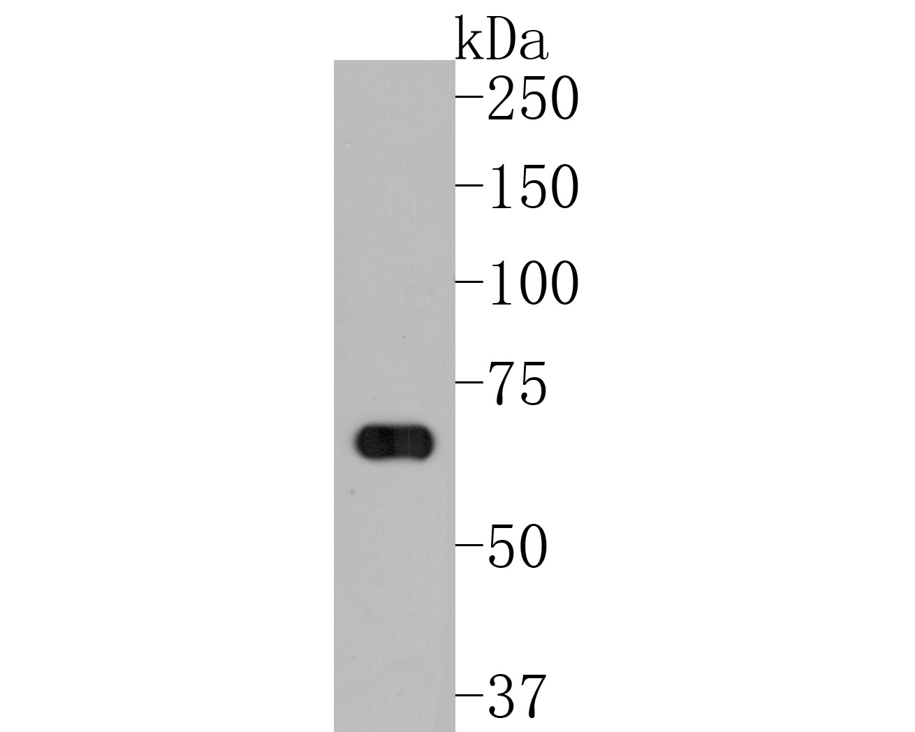 Western blot analysis of NEDD1 on mouse lung lysates. Proteins were transferred to a PVDF membrane and blocked with 5% NFDM/TBST for 1 hour at room temperature. The primary antibody (HA500294, 1/1,000) was used in 5% NFDM/TBST at room temperature for 2 hours. Goat Anti-Rabbit IgG - HRP Secondary Antibody (HA1001) at 1:200,000 dilution was used for 1 hour at room temperature.