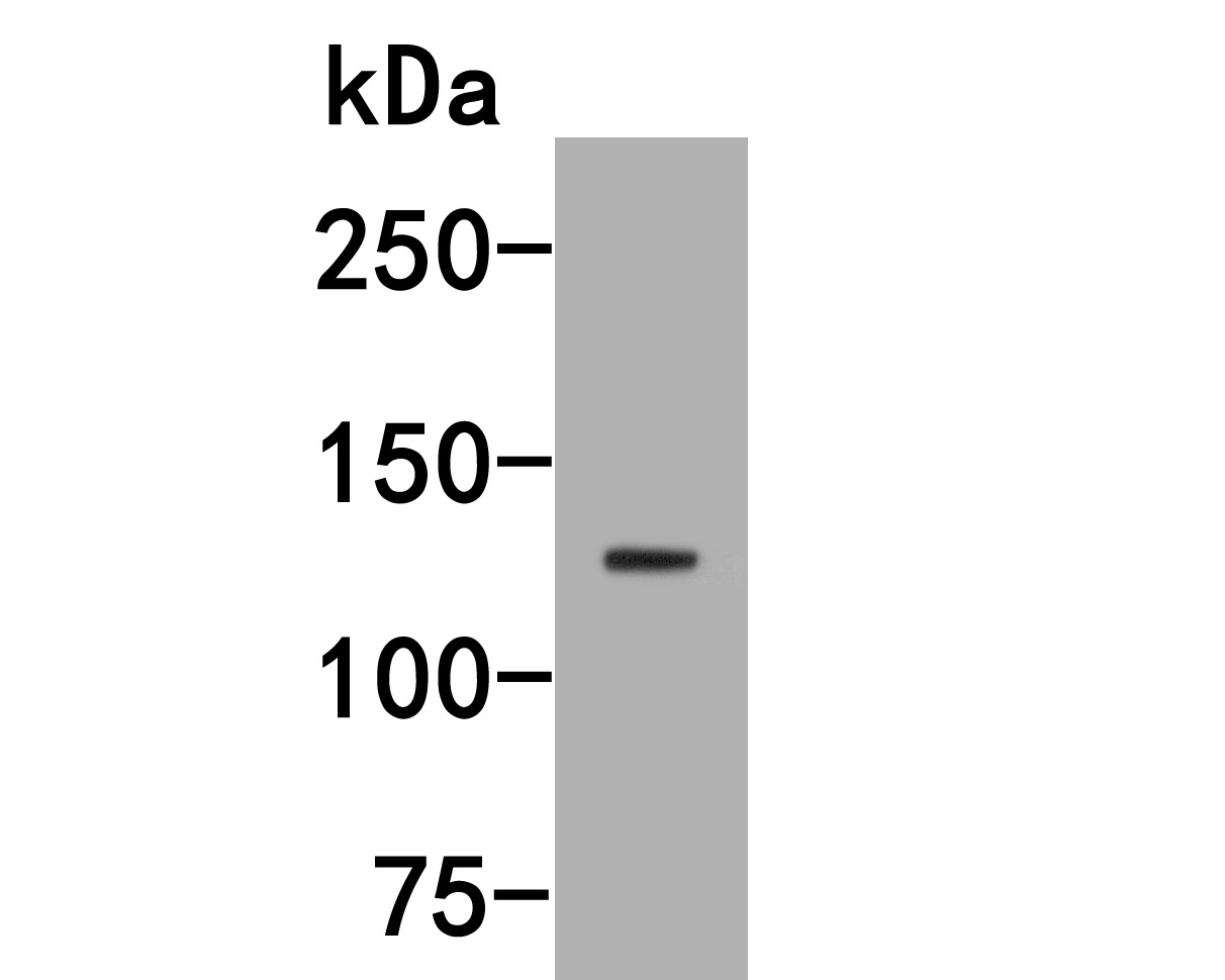 Western blot analysis of MyT1L on SHSY5Y cell lysates. Proteins were transferred to a PVDF membrane and blocked with 5% NFDM/TBST for 1 hour at room temperature. The primary antibody (HA500297, 1/1,000) was used in 5% NFDM/TBST at room temperature for 2 hours. Goat Anti-Rabbit IgG - HRP Secondary Antibody (HA1001) at 1:200,000 dilution was used for 1 hour at room temperature.