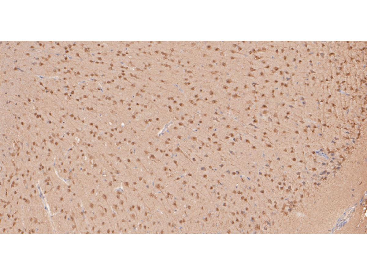 Immunohistochemical analysis of paraffin-embedded mouse brain tissue using anti-MyT1L antibody. The section was pre-treated using heat mediated antigen retrieval with sodium citrate buffer (pH 6.0) for 20 minutes. The tissues were blocked in 5% BSA for 30 minutes at room temperature, washed with ddH2O and PBS, and then probed with the primary antibody (HA500297, 1/400)  for 30 minutes at room temperature. The detection was performed using an HRP conjugated compact polymer system. DAB was used as the chromogen. Tissues were counterstained with hematoxylin and mounted with DPX.
