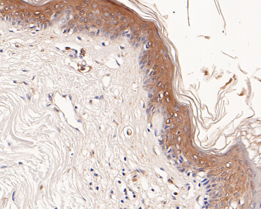 Immunohistochemical analysis of paraffin-embedded human skin tissue using anti-CX3CL1 antibody. The section was pre-treated using heat mediated antigen retrieval with Tris-EDTA buffer (pH 9.0) for 20 minutes.The tissues were blocked in 5% BSA for 30 minutes at room temperature, washed with ddH2O and PBS, and then probed with the primary antibody (HA500304, 1/200) for 30 minutes at room temperature. The detection was performed using an HRP conjugated compact polymer system. DAB was used as the chromogen. Tissues were counterstained with hematoxylin and mounted with DPX.